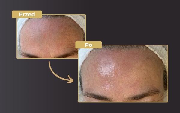 4 etapowa pielęgnacja Magic Glow Face – zabieg z efektem "wow" 59% taniej! - obrazek 3
