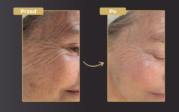 4 etapowa pielęgnacja Magic Glow Face – zabieg z efektem "wow" 59% taniej! - obrazek 2