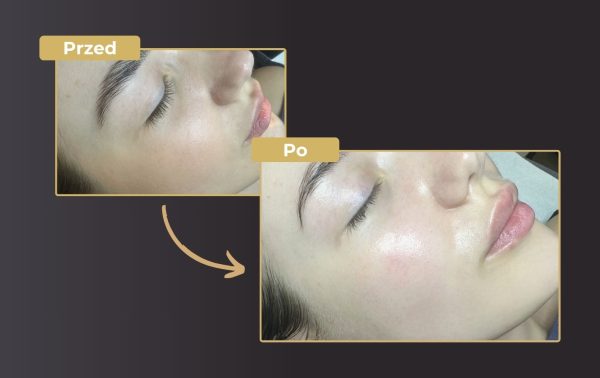 SOLT OUT 4 etapowa pielęgnacja Magic Glow Face – zabieg z efektem "wow" 59% taniej! - obrazek 4