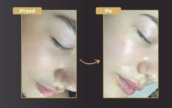 SOLT OUT 4 etapowa pielęgnacja Magic Glow Face – zabieg z efektem "wow" 59% taniej! - obrazek 5